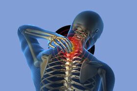 Servikal osteokondroz semptomları