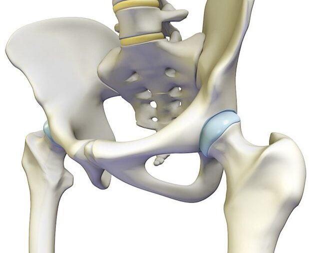 Osteokondroz kalça ekleminde keskin bir ağrıya neden olur